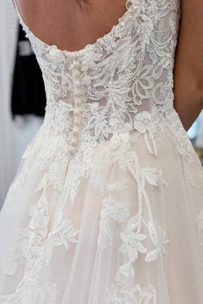 Woman wearing a white lace wedding dress.